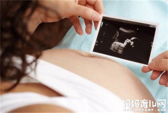 胎心率看男女准确率八九不离十 已经得到多位宝妈验证！ 