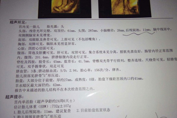 四维彩超看生男生女 四维生男生女暗号请收好 