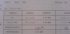 唐筛单子上有男女暗示可提前预知生男生女？