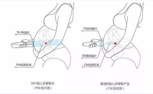 胎心仪应该怎么用？