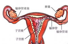 输精管堵塞会引起不孕?专家在线