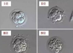胚胎级别的划分 胚胎级别10.9.8.怎么分