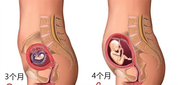 怀孕1～10月肚子变化 图文解读胎儿发育全过程 