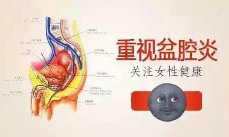 女性盆腔炎的症状