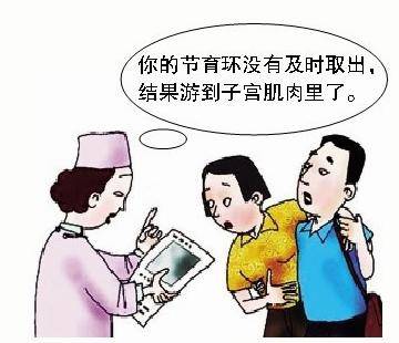 节育环哪种最好，需要多久换一次?