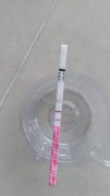 二胎备孕检查有哪些项目？