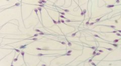 畸形精子类别多，简述不同形态的精子对怀孕的影响