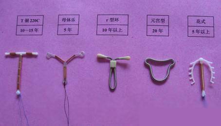 节育环的原理与作用是什么?
