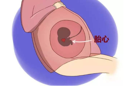 试管婴儿胚胎移植后腹部两侧疼是不是宫外孕？