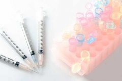 性激素6项检查什么 女性激素6项多少钱（费用）