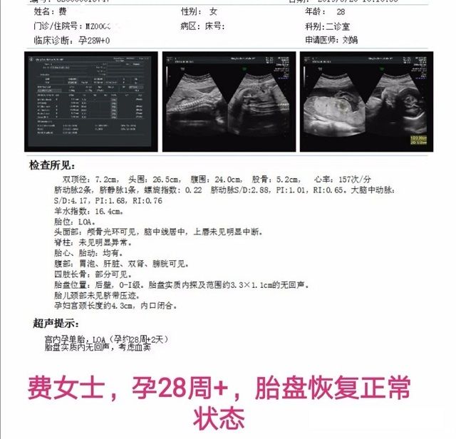 17周胎盘前置B超