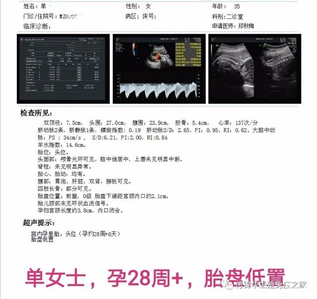 28周胎盘前置案例
