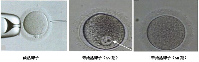 不同形态的卵泡