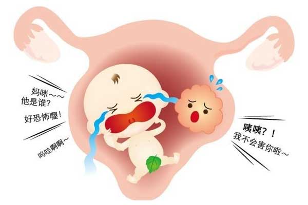 子宫肌瘤对怀孕的影响不可忽视