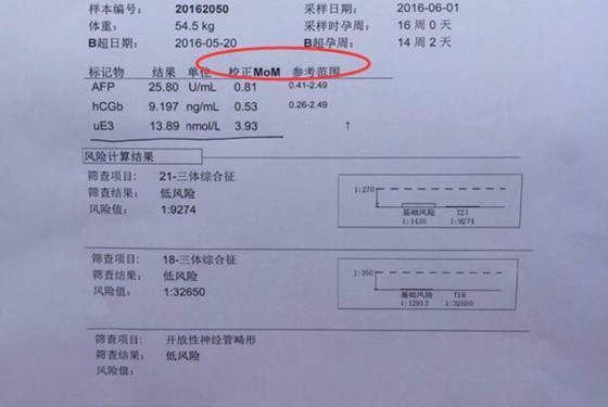 唐氏筛查看男女：AFP值>1是男孩<1是女孩真的准吗？ 