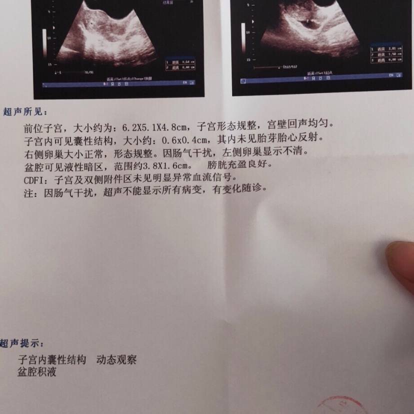 试管婴儿图片
