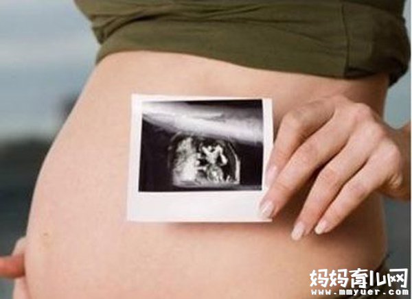 六个月的胎儿图什么样 五张胎儿图来解读 