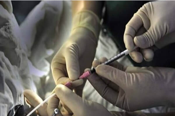 过来人自述人工受孕详细过程 从来就没这么尴尬过 