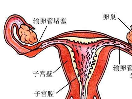 炎症引发的输卵管不通可以去武汉做试管婴儿吗