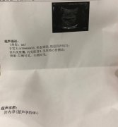 宫腔镜检查注意事项，这些事要重视