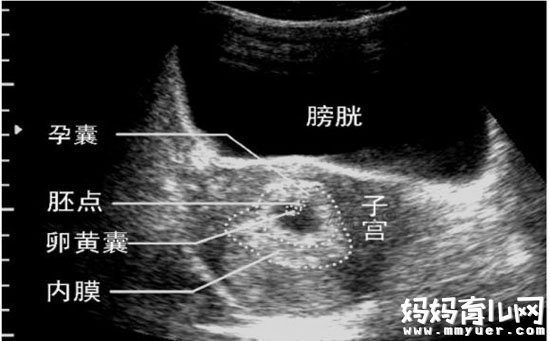 手把手教你看孕囊大小对照表 胎儿发育早知道 