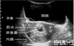 手把手教你看孕囊大小对照表 胎儿发育早知道