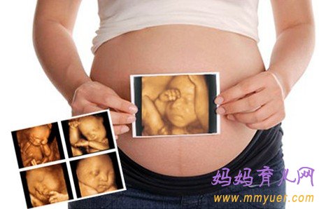 孕妇做四维彩超最佳时间（附图） 