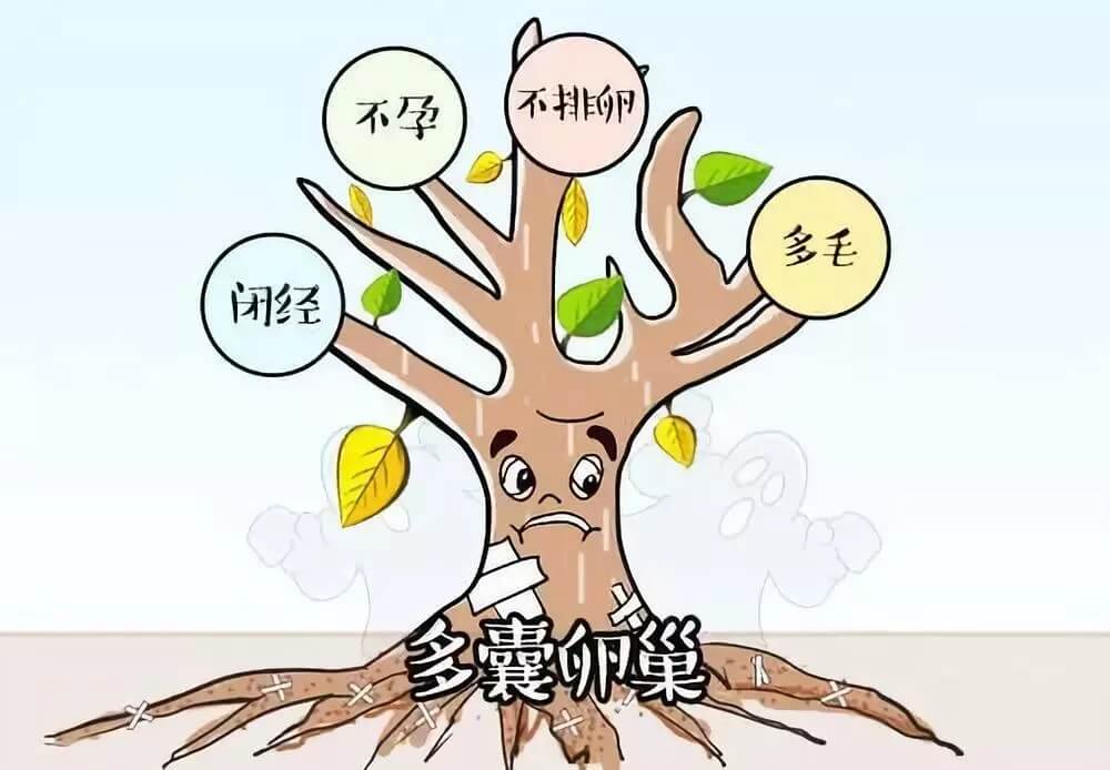 肥胖型多囊可以做泰国试管婴儿吗？泰安试管婴儿来告诉你