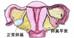 怎么提高泰国试管婴儿的成功率呢?