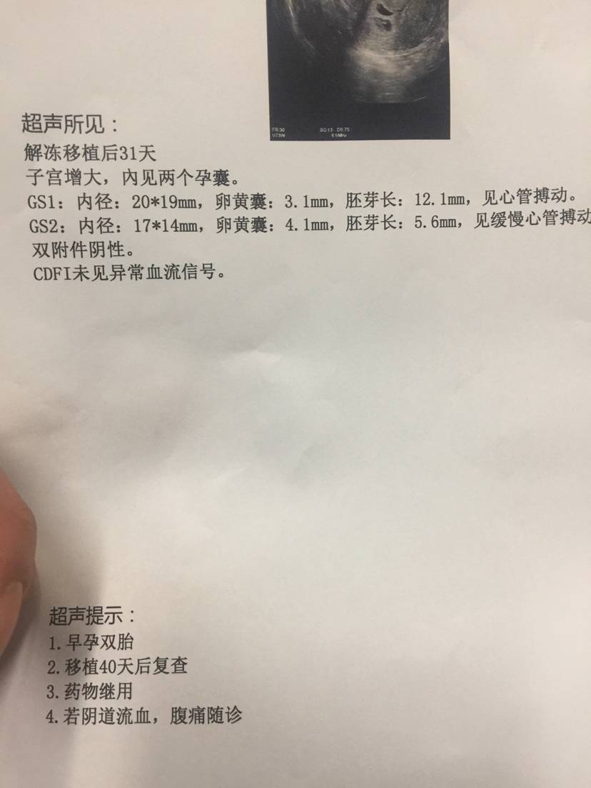 试管婴儿图片
