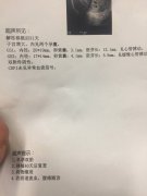 速看！孕前检查要注意这五大事项