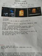 30周男孩女孩b超区别图