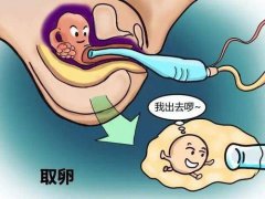 试管婴儿取卵会很痛么