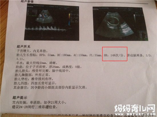 胎心超过140的真的是男孩吗 胎心的这些秘密你知道吗 