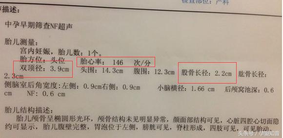 四维单子有暗示男女吗 亲手教你四维单子上怎么看m和f 