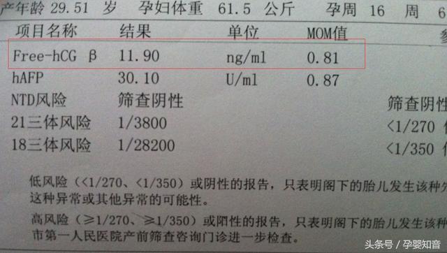 四维单子有暗示男女吗 亲手教你四维单子上怎么看m和f 