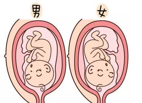 唐氏筛查看性别准吗?
