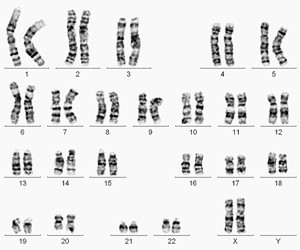 人类正常染色体核型图（女性：46，XX）