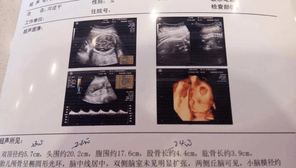 传承生殖医学试管怎么样
