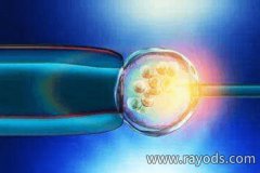 是什么原因让越来越多的人相信泰国试管婴儿成功率呢