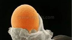 广西W姐卵巢早衰做试管婴儿怀孕的几率大吗？
