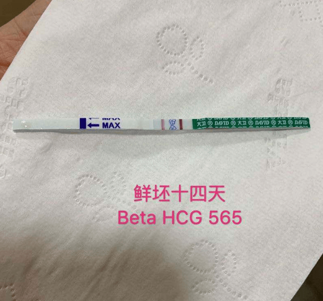 传承生殖中心包男孩总费用多少