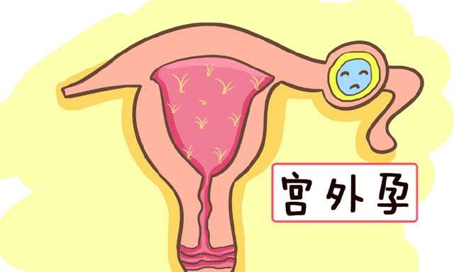 宫外孕用试纸能试出来吗 宫外孕检测方法大全