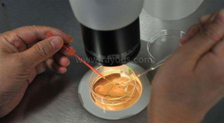 试管婴儿取卵是怎么操作的？