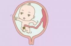 怀孕九个月胎儿图， 怀孕九个月要注意哪些