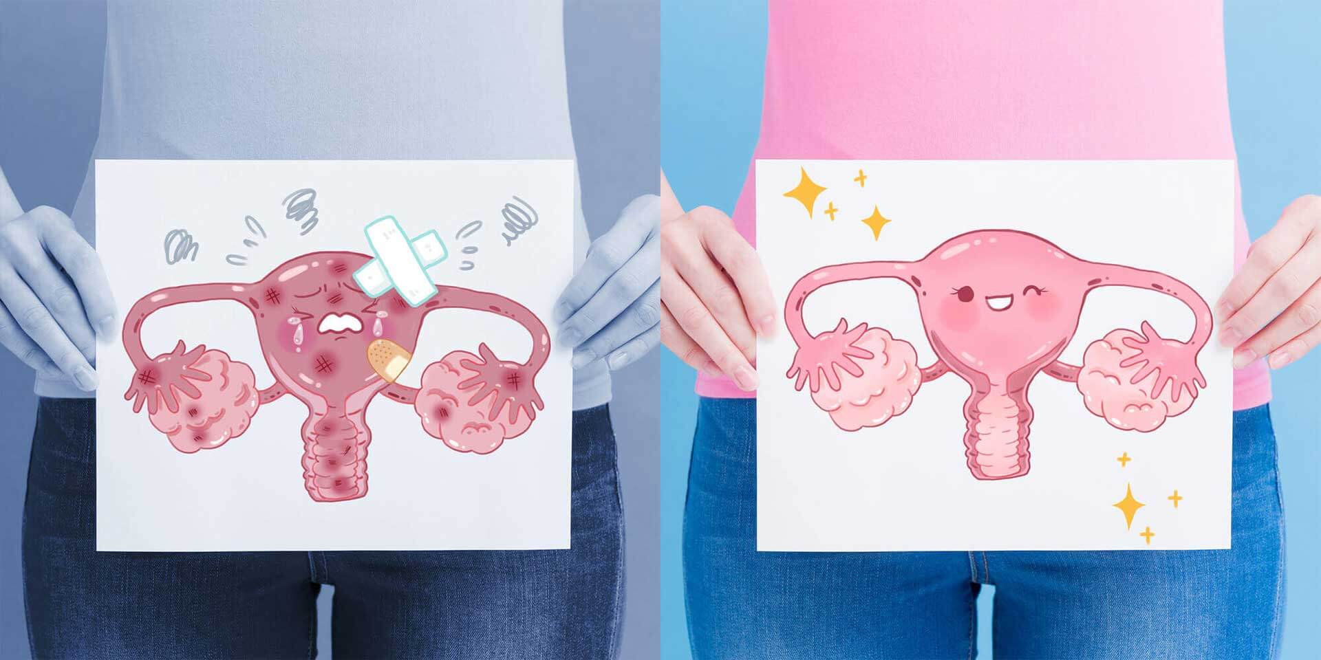 子宫内膜壁薄怎么办？子宫内膜壁薄应该如何治疗？