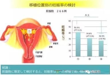 日本做试管婴儿花多少钱