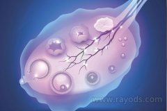 为什么试管婴儿取卵总是失败？怎样取卵才能成功？