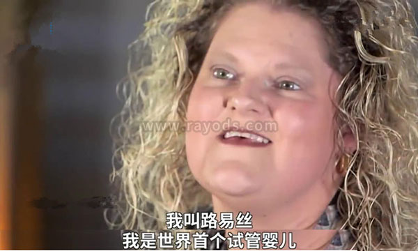 第一例试管婴儿现在怎么样了