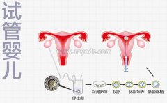 什么是试管婴儿囊胚培养？赶快看囊胚培养的过程图